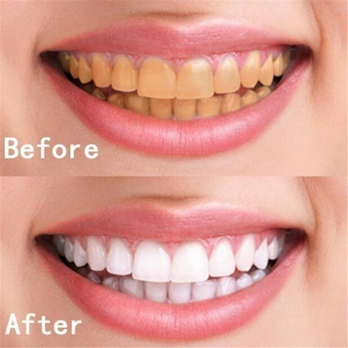 Crofta 10ml Teeth Whitening Water Oral Hygiene Cleaning Teeth Care Tooth Cleaning