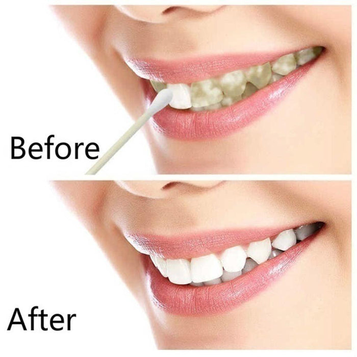 Crofta 10ml Teeth Whitening Water Oral Hygiene Cleaning Teeth Care Tooth Cleaning