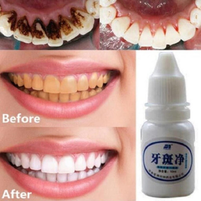 Crofta 10ml Teeth Whitening Water Oral Hygiene Cleaning Teeth Care Tooth Cleaning