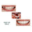 Crofta 1Pair Silicone Upper/Lower False Teeth Dental Veneers Dentures Fake Tooth 02