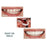 Crofta 1Pair Silicone Upper/Lower False Teeth Dental Veneers Dentures Fake Tooth 02