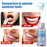 Crofta 1 Bottle Thermal Fitting Beads Temporary Teeth Repair Thermal Beads 10ml