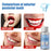 Crofta 1 Bottle Thermal Fitting Beads Temporary Teeth Repair Thermal Beads 30ml