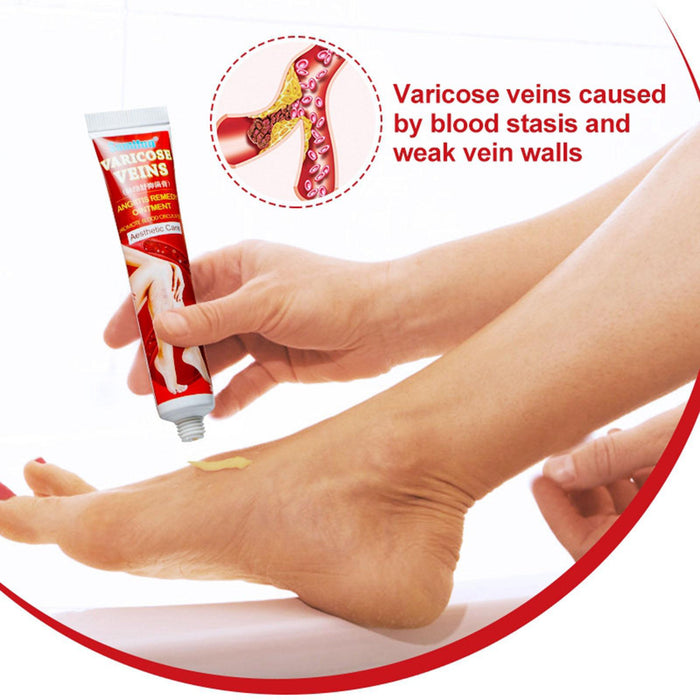 Crofta 2 Pack Varicose Vein Ointment Vasculitis Cream Varicosity Removal Plaster