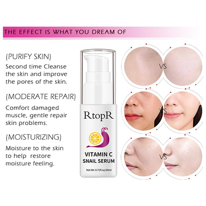 Vitamin C Serum Snail Serum Face Serum for Oil Control Bright Skin Whitening