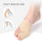 2 Pieces Bunion Corrector Straightening Day Night Support for Hammer Toe