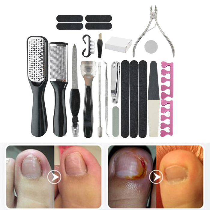 23 in 1 Manicure Foot Pedicure Kit Callus Remover Cracked with Case