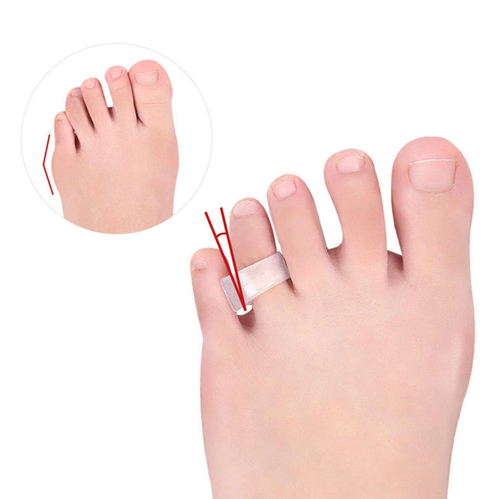 Toe Bunion Guard Correct Crooked Toes for Overlapping Toe 2.8x1.15x2.2cm