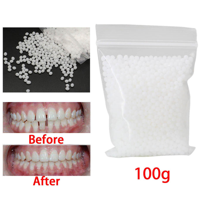 Crofta 100G Temporary Tooth Repair Kit for Uneven Teeth Teeth Veneer Beauty Tool