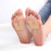 2x U Shaped Felt Callus Pads Reduce Foot Pain Comfortable  Skin Color