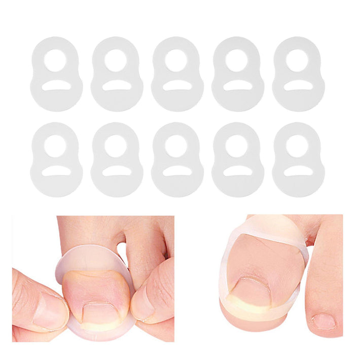 Crofta 10 Pieces Ingrown Toenail Corrector Reusable Silicone for Adults Male Female